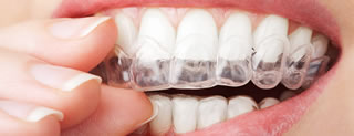 Whiten Teeth Leicester RD Dental